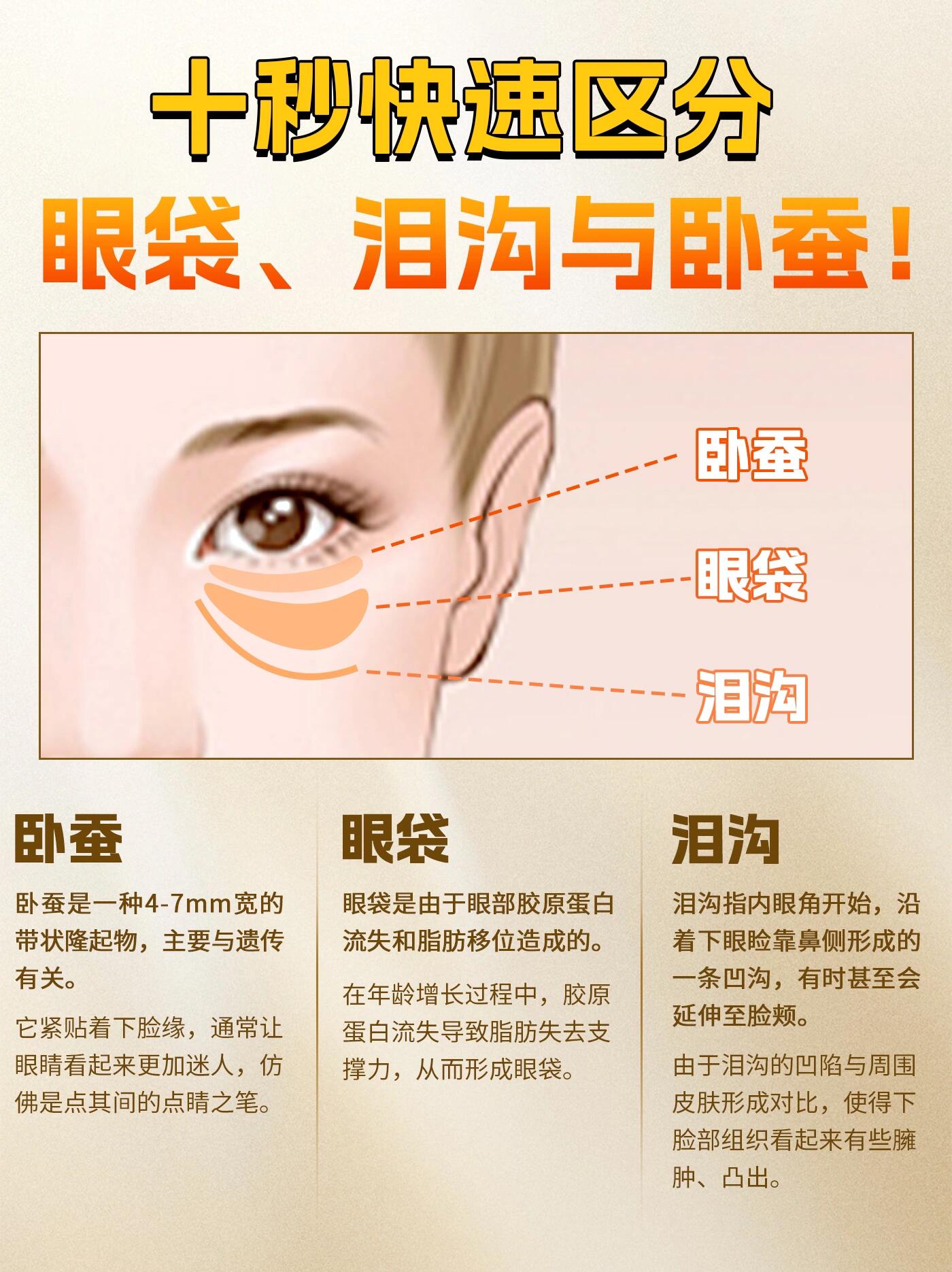 眼袋和卧蚕的区别，眼袋和卧蚕的区别图片对比
