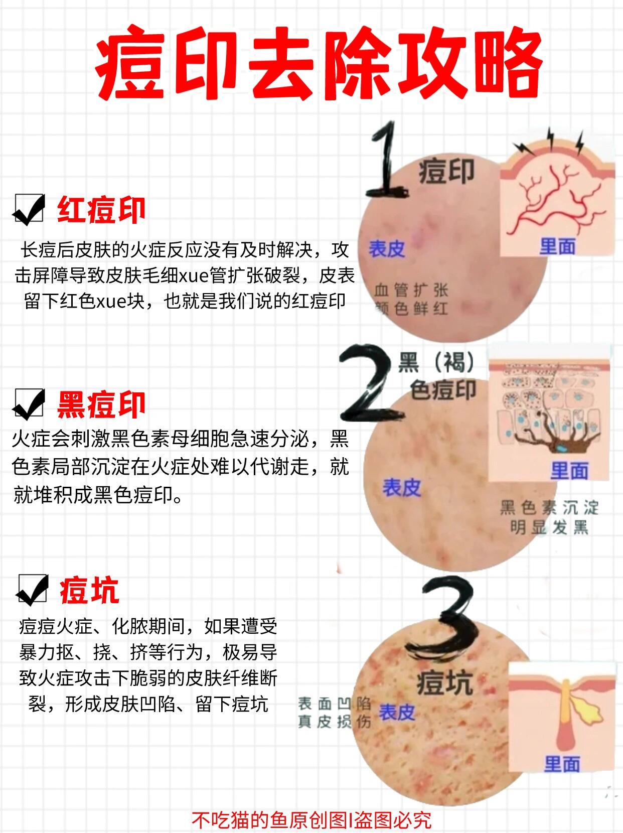 痘印怎么去除，痘印的消除方法