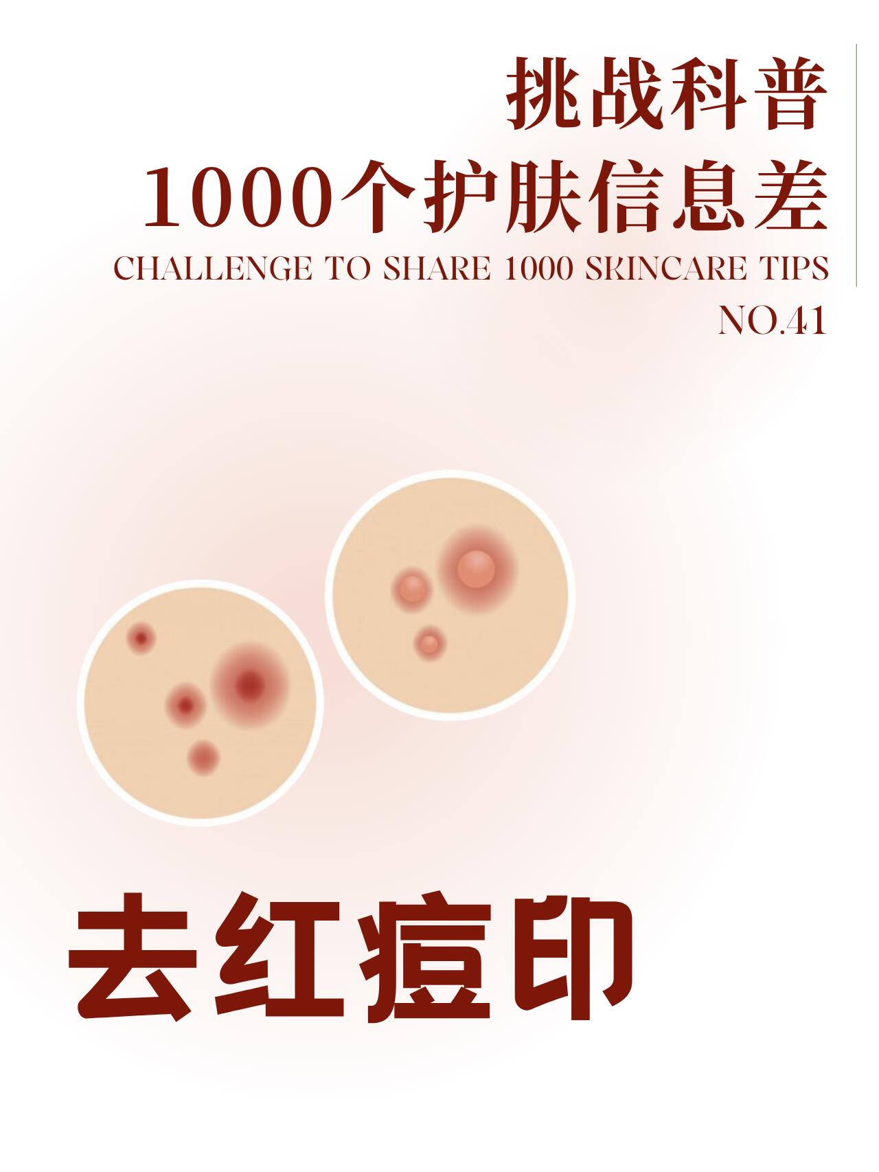 红痘印一直消不下去怎么办，红痘印怎么去除掉